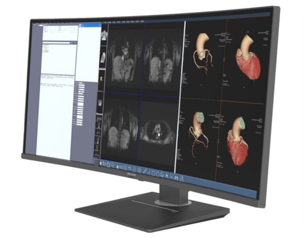 Ecra presenta a Exposanità il nuovo sistema diagnostico curvo a 6 MP