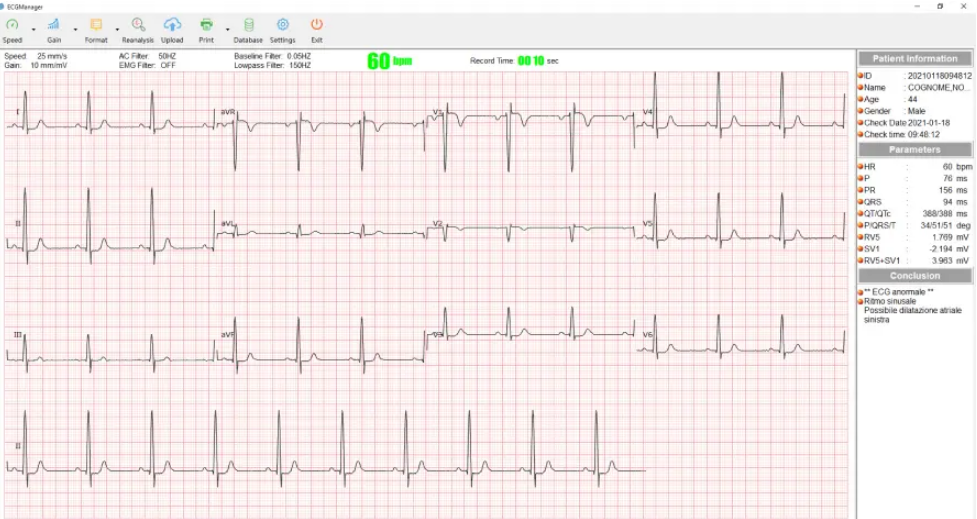 Software ECG Manager