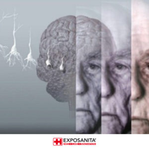 Grafica inizativa demenza